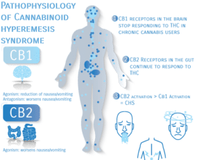 Cannabis Hyperemesis Syndrome - Core Revitalizing Center