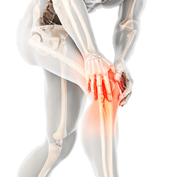 knee pain joint orthopedic physical therapy Banu Acan DPT Core Revitalizing Center Sarasota Bradenton ankle wrist hip