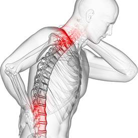 Posture assessment analysis back neck pain Banu Acan Physical Therapy PT Top rated qualified near me lakewood ranch bradenton sarasota